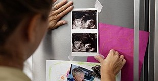 Ультразвуковое сканирование - «Беременность»